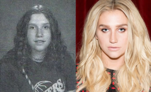 kesha